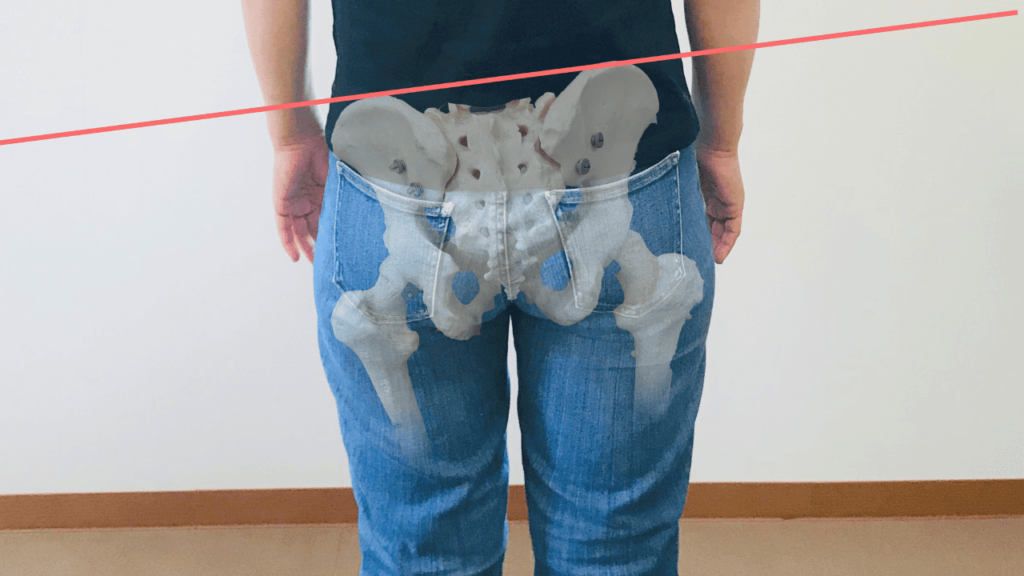 骨盤の歪み