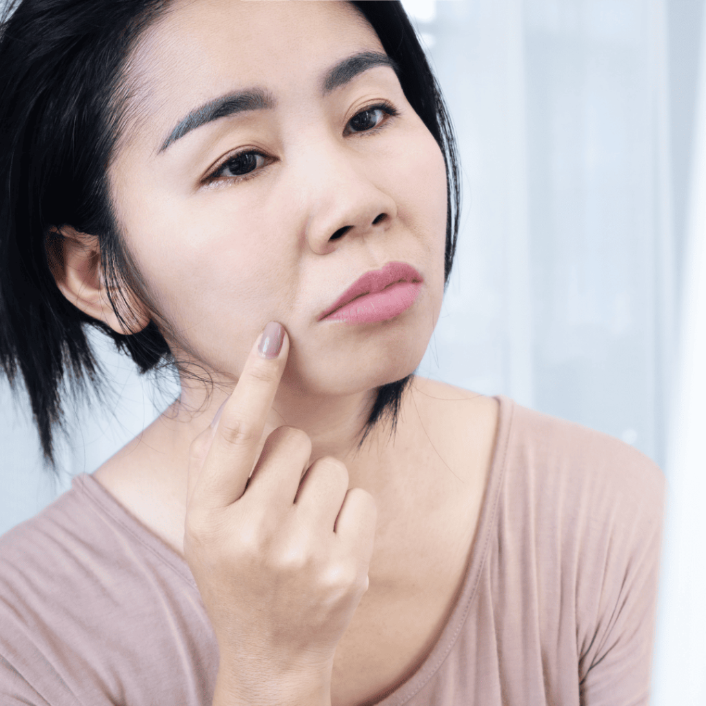 ほうれい線　しわ　たるみ