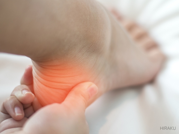 踵　シーバー病