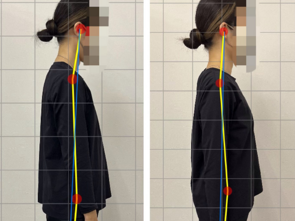 首コリ 姿勢チェック